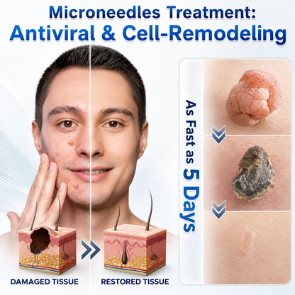 💕👩🏻‍⚕️ 𝐎𝐟𝐟𝐢𝐜𝐢𝐚𝐥 𝐒𝐭𝐨𝐫𝐞 | 𝑵𝐞𝒌𝐢𝐬𝐬® 🌿 𝐁𝐨𝐭𝐚𝐧𝐢𝐜𝐚𝐥 𝐌𝐢𝐜𝐫𝐨𝐧𝐞𝐞𝐝𝐥𝐞 𝐇𝐲𝐝𝐫𝐨𝐜𝐨𝐥𝐥𝐨𝐢𝐝 𝐏𝐚𝐭𝐜𝐡 (𝐅𝐨𝐫 𝐒𝐤𝐢𝐧 𝐓𝐚𝐠𝐬, 𝐒𝐦𝐚𝐥𝐥 𝐒𝐤𝐢𝐧 𝐆𝐫𝐨𝐰𝐭𝐡𝐬, 𝐖𝐚𝐫𝐭𝐬, 𝐌𝐨𝐥𝐞𝐬, 𝐀𝐠𝐞 𝐒𝐩𝐨𝐭𝐬 & 𝐏𝐢𝐠𝐦𝐞𝐧𝐭𝐚𝐭𝐢𝐨𝐧 𝐂𝐨𝐧𝐜𝐞𝐫𝐧𝐬)